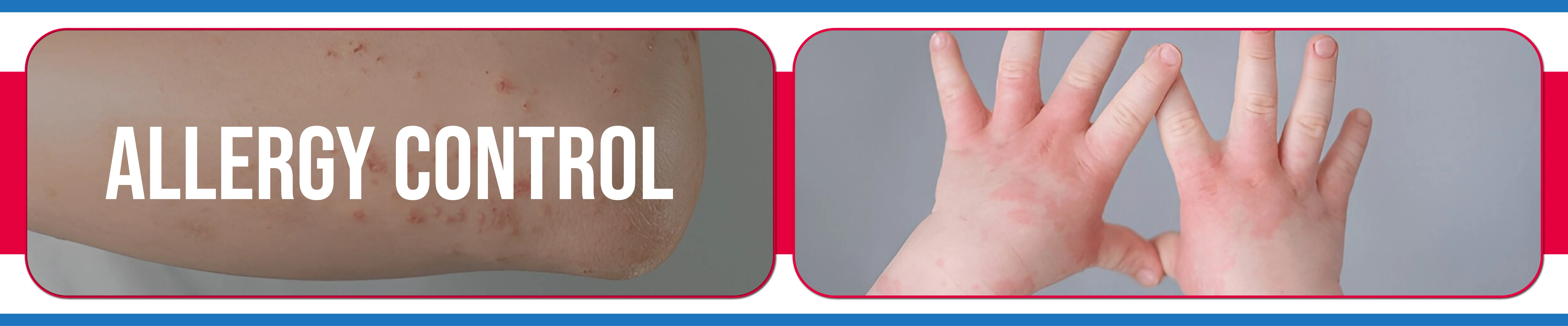 carpet cleaning in Nassau, carpet cleaner in Nassau, carpet cleaners in Nassau, carpet cleaners in new york, commercial carpet cleaning, commercial carpet cleaning in Nassau, rug cleaning in Nassau,rug cleaners Nassau, Nassau rug cleaners, rug cleaning services in Nassau, same day carpet cleaning,pet cleaning in Nassau, pet cleaner in Nassau, pet cleaners in Nassau, pet cleaners in new york, organic cleaning in Nassau, organic cleaner in Nassau, organic cleaners in Nassau, organic cleaners in new york, mattress cleaning in Nassau, mattress cleaner in Nassau, upholstery cleaners in Nassau, upholstery cleaners in new york, Miscellaneous cleaning in Nassau, Miscellaneous cleaner in Nassau, bed bug cleaners in Nassau, bed bug cleaners in new york, damage service in Nassau, allergy control in Nassau, same day rug cleaning