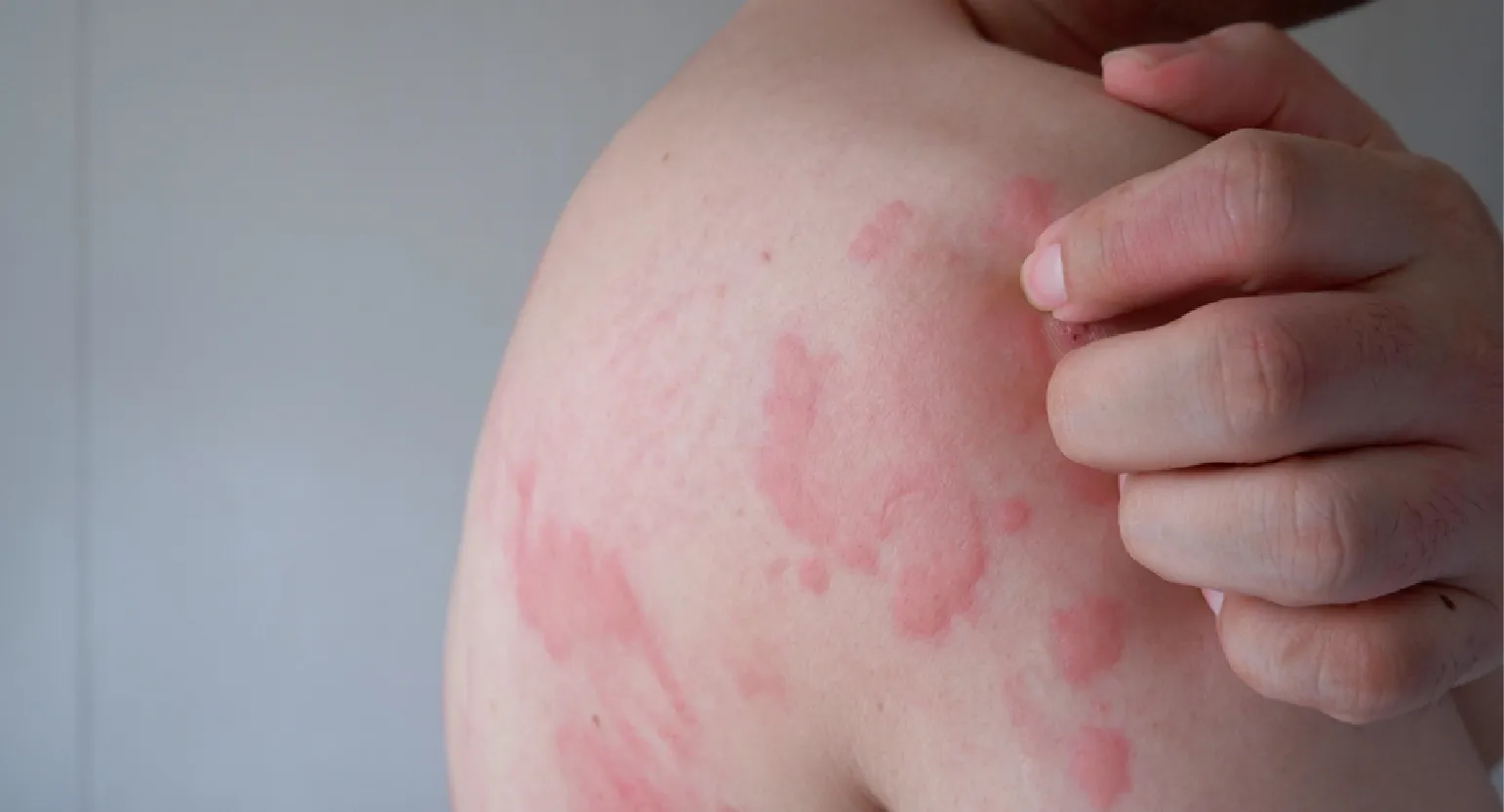 carpet cleaning in Nassau, carpet cleaner in Nassau, carpet cleaners in Nassau, carpet cleaners in new york, commercial carpet cleaning, commercial carpet cleaning in Nassau, rug cleaning in Nassau,rug cleaners Nassau, Nassau rug cleaners, rug cleaning services in Nassau, same day carpet cleaning,pet cleaning in Nassau, pet cleaner in Nassau, pet cleaners in Nassau, pet cleaners in new york, organic cleaning in Nassau, organic cleaner in Nassau, organic cleaners in Nassau, organic cleaners in new york, mattress cleaning in Nassau, mattress cleaner in Nassau, upholstery cleaners in Nassau, upholstery cleaners in new york, Miscellaneous cleaning in Nassau, Miscellaneous cleaner in Nassau, bed bug cleaners in Nassau, bed bug cleaners in new york, damage service in Nassau, allergy control in Nassau, same day rug cleaning